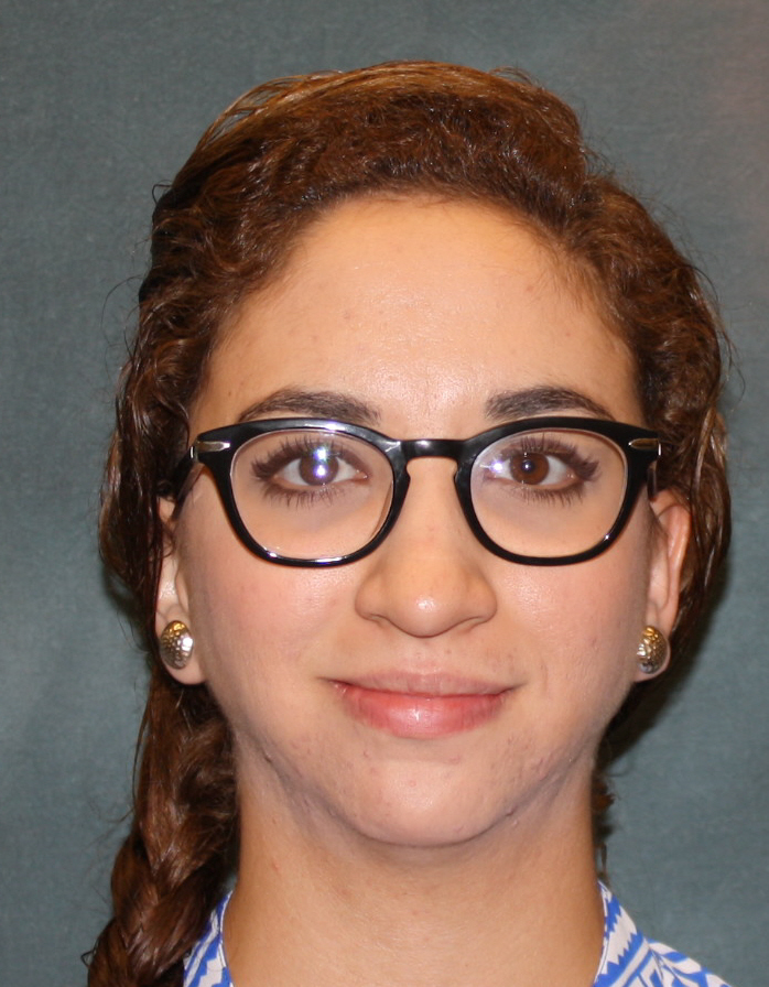 Reyna E. Balderas