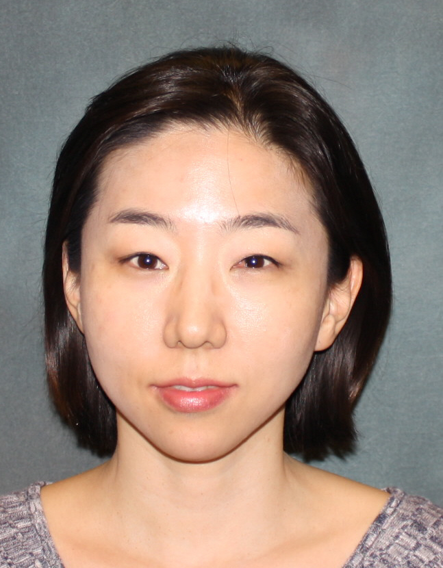 Yoon Hi Sung